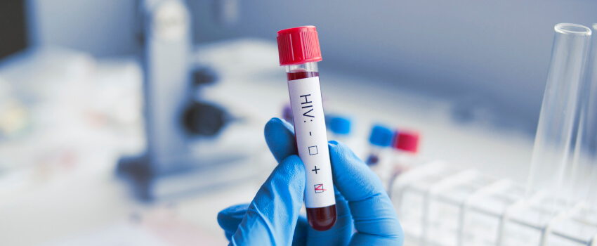 HIV blood sample